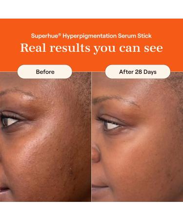 Live Tinted Superhue Hyperpigmentation Serum Stick - Balm-to-Serum Stick For Face & Body & Hueguard: 3-in-1 Mineral Sunscreen Moisturizer & Primer for Face and Body - Travel Sized - SPF 30 - Buy Online on GoSupps.com
