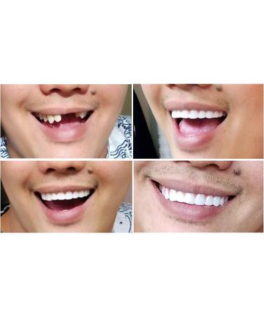 Instant Smile Comfort Fit Flex - Bright White Upper Veneer Cosmetic Teeth - Buy Online on GoSupps.com