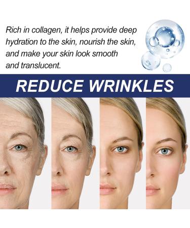 Moisturizer Face Cream with Retinol Collagen & Hyaluronic Acid | Anti-Aging Hydrating Lotion for Men & Women - 1.7 oz - Buy Online on GoSupps.com