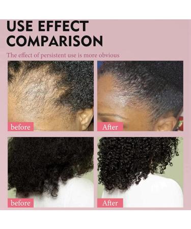 Chebe Hair Butter Chebe Powder For Hair Growth Chebe Chebe Hair Butter Hair Butter Deep Moisturization Hair Growth Products For All Hair Types Vegan Hair Oil Vegan Hair Growth Oil (Butter Texture) - Buy Online on GoSupps.com