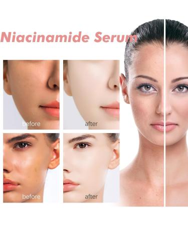 (Most Gifts) 2024 New Peach 70% Niacinamide Serum+Dark Spot Correcting Serum 30ml/1.01fl.oz - Buy Online on GoSupps.com