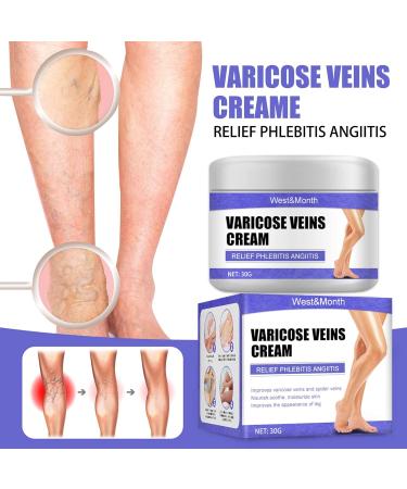 30g Varicose Vein Cream - Spider Vein Treatment & Phlebitis Skin Care Ointment for Improved Blood Circulation & Relief for Tired Legs - Buy Online on GoSupps.com