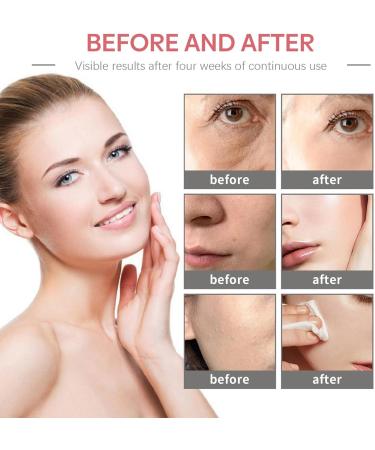 Natural Moisturizing Factors + HA 100ml Face Cream and Moisturiser for Normal to Dry Skin Skin Care Essentials Hydrates Skin Lightweight and Gentle Skincare - Buy Online on GoSupps.com