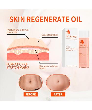 Optimal Oil Stretch Mark Oil Body Oil for Women Stretch Marks Removal Body Oil Collagen Boost Firming & Lifting Skincare Oil Anti Stretch Mark Cream Pregnancy Nuture Nourishing Skin Treatment Oil - Buy Online on GoSupps.com