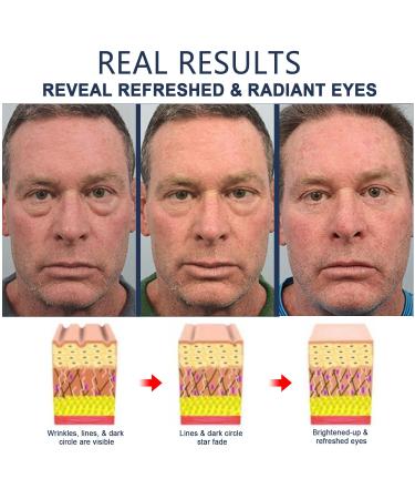 OPENEYES Awaken Peptide Lifting Eye Gel for Men - Anti Aging, Depuffing, and Moisturizing Eye Cream - Reduce Eye Bags, Wrinkles, and Dark Circles - 3PCS - Buy Online on GoSupps.com