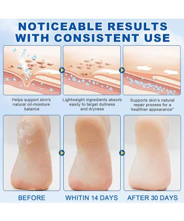 tysumeoy Foot cream with 60 urea for very dry skin - Buy Online on GoSupps.com