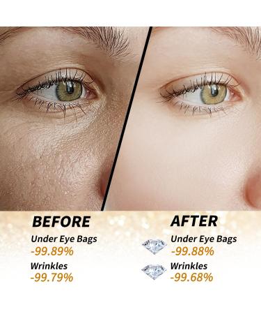 Golden Glow Under Eye Patches - 60 Pcs Rejuvenating Eye Gels for Dark Circles & Puffiness Relief - Buy Online on GoSupps.com