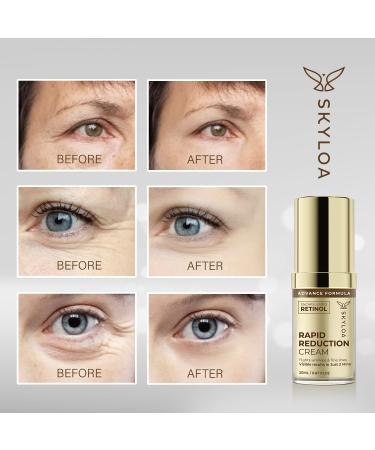 Retinol Eye Cream - Anti-Aging Under Eye Serum for Dark Circles & Puffiness | Hyaluronic Acid & Caffeine | Reduces Wrinkles & Fine Lines (20ML - Buy Online on GoSupps.com