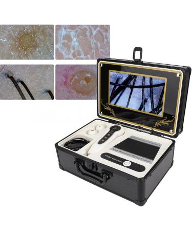 9 Inch Skin Diagnosis Hair Analyzer 50X 200X Dual Lens Skin Hair Scalp Detector Analyzer Professional Skin Care Analyser Tool for Skin Care Skin Health Detection Home Salon - Buy Online on GoSupps.com