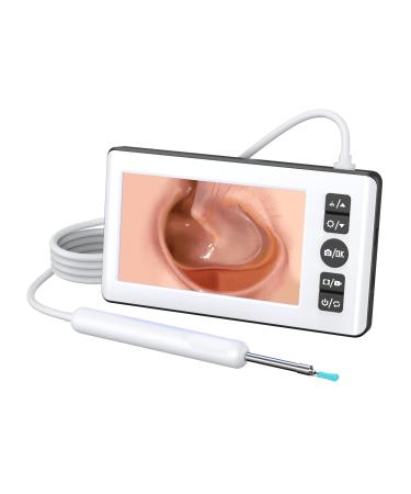 visclyn Earwax Removal Kit - Standalone Ear Cleaner with 4.3" IPS Display 1080P HD Camera Intuive Button Operation 3H Continuous Working 9 Silicone Tips No Phone Required