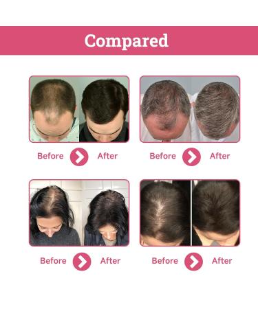 Strawberry Mint Hair Oil | Organic Growth Serum for Thin & Damaged Hair (2PCS) - Buy Internationally - Buy Online on GoSupps.com