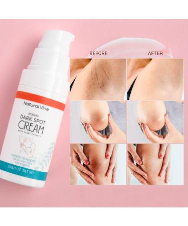 Natural Vine Dark Spot Corrector: Dark Spot Remover for Body in 4-8 Weeks - Instant Concealing & Age Brown Sun Faded Spot Remover Melasma Freckles Correcting with Niacinamide for Women & Men 30g 1 Ounce (Pack of 1) - Buy Online on GoSupps.com