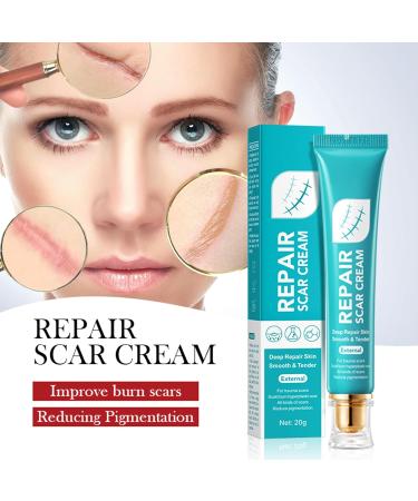 Shantou Youjia 2 bottles of scar cream scar ointment after scar gel scar - Buy Online on GoSupps.com