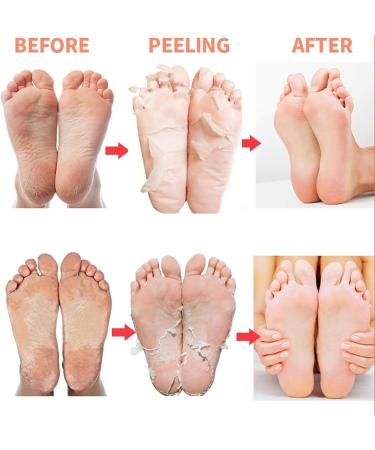 Revitalize Your Feet: 5 Pairs Coconut Milk Peeling Foot Mask & Salt Spa - Moisturizing Care for Dry Cracked Skin | Men's & Women's Foot Treatment - Buy Online on GoSupps.com