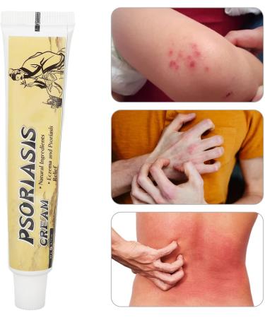 Antis Itching Cream - Natural Relief for Red Rash Psoriasis & Skin Problems | 20g - Buy Online on GoSupps.com