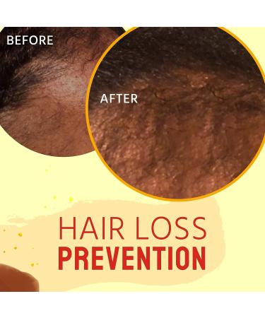 Glammed Naturally Hair Growth Oil - 100% Natural 2oz for Kids, Teen, Adult - Buy Online on GoSupps.com