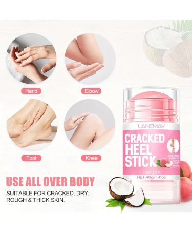 Sitovely Urea Cream Stick 2 pieces highly effective foot care creams for rough thick dry and cracked skin foot cream for feet knees elbows and hands of women and men B M - Buy Online on GoSupps.com