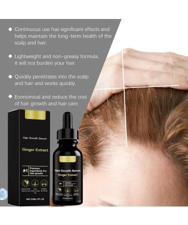 Huile Pousse Cheveux Anti-Chute Pour Femme Et Homme S rum Naturel Avec Huile De Ricin et Gingembre Booster Croissance Cheveux Non Irritante Traitement Rapide Pour Repousse 30ml - Buy Online on GoSupps.com
