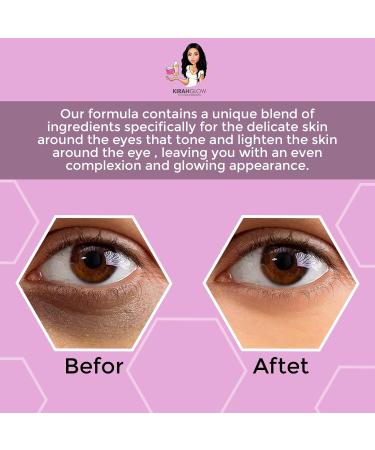KirahGlow Revitalizing Eye Cream | Dark Circle Treatment | Depuffing & Hydrating Under-Eye Formula | With Caffeine & Natural Extracts | Fragrance-Free - Buy Online on GoSupps.com
