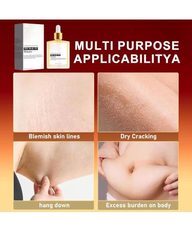  ulapithi Body Oil - 50ml Lightweight Refreshing Moisturizer | Non-Greasy Body Lotion - For Legs Arms Hands and Stomach - Smoother Skin - Home Travel - Women and Men - Buy Online on GoSupps.com