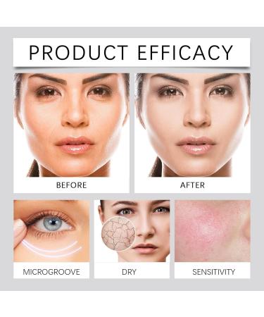 Anti-spot urea cream vitamin E urea cream vitamin E cream for removing dark spots moisturizes and nourishes skin care soft skin reduces (1) - Buy Online on GoSupps.com