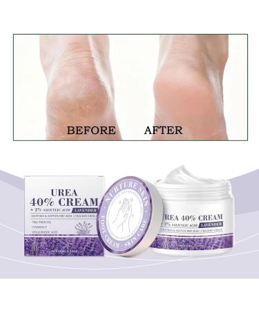 Cream for Dry Feet | Nourishing Corn Remover | Repairing Treatment for Dry and Cracked Foot Skin | for Men Women Knees Elbows Hands Night Shower Daily Morning Evening Winter - Buy Online on GoSupps.com