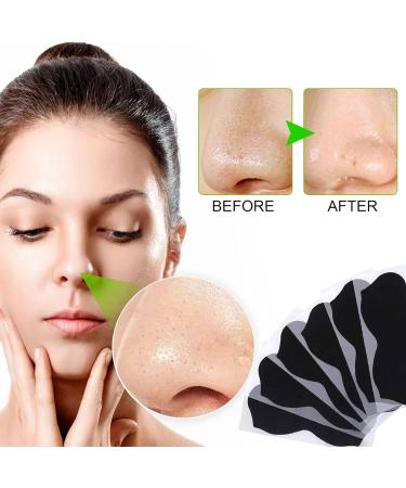 Nose Strips Blackhead Pore Strips Blackhead Remover-Deep Cleansing Charcoal Strips Nose Blackhead Remover Strips Black Head Remover Blackhead Pore Strips for Women Men (80 Counts) - Buy Online on GoSupps.com