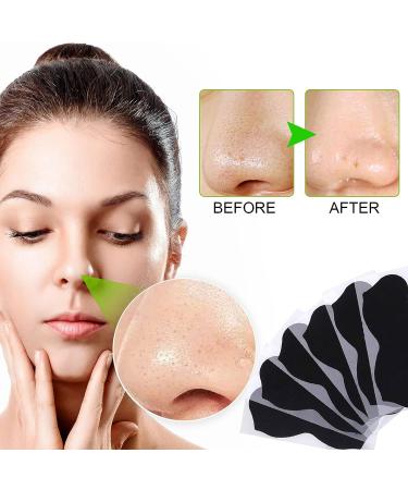 Charcoal Blackhead Remover Nose Strips - 80 Pcs Deep Cleansing Pore Strips for Men & Women - Buy Online on GoSupps.com