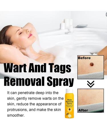 Plant-Based Skin Spray with Bee Venom and Salicylic Acid - For External Use Gentle Non-Irritating Formula to Improve Skin Appearance At-Home Care for Men & Women (2) - Buy Online on GoSupps.com