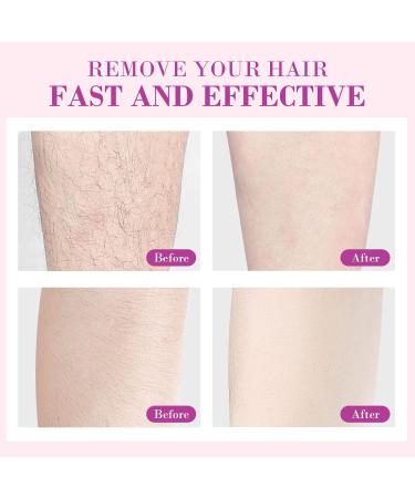 Crystal Hair Eraser Nano Remover - Painless Exfoliation for Men and Women - Magic Hair Removal Tool - Silver Rose - Buy Online on GoSupps.com