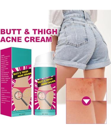  KOAHDE Anti-acne cream for buttocks cleansing cream for buttock acne buttock acne cleansing treatment cream for hips and buttocks treatment to eliminate - Buy Online on GoSupps.com