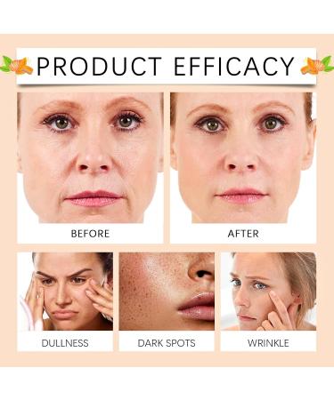 Turmeric Face Cream Natural Turmeric Anti Aging Cream Turmeric Face Moisturiser Anti Aging Face Cream Dark Spot Corrector Remover For Face & Body Glowing Skin Moisturizer Moisturizing Lotion - Buy Online on GoSupps.com
