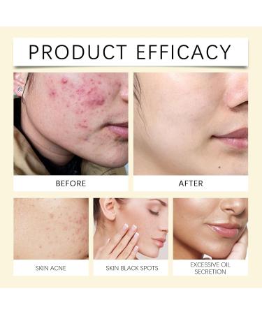 Nettoyant Visage Doux Et Nettoyant - Nettoyage En Profondeur Exfoliant quilibre Le S bum Doux For Tous Les Types De Peau (y Compris Les Peaux Sensibles)(2PCS) - Buy Online on GoSupps.com