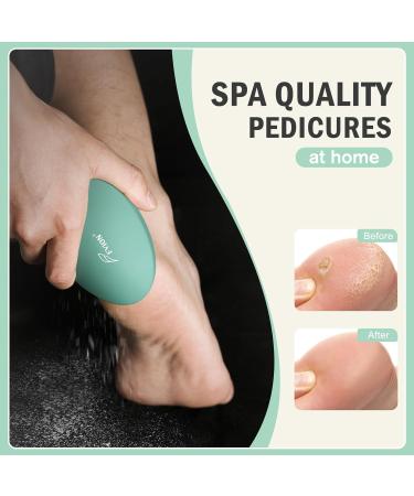 FVION Nano Glass Foot File Callus Remover Gentle Glass Foot Hard Skin Foot Scraper Effective Feet Scrubber for Dead Skin and Portable Pedi Egg Foot Care Tool (Green) - Buy Online on GoSupps.com