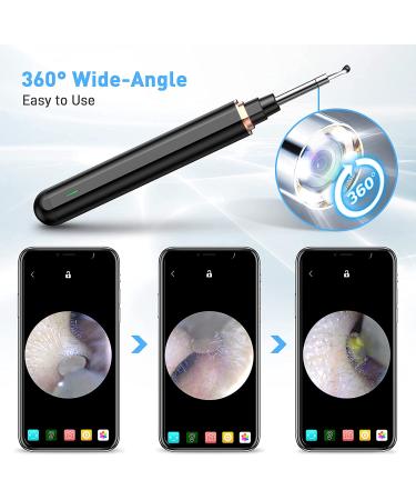 AWELOR Ear Wax Removal Camera - 1296P HD Endoscope Ear Cleaner for iPhone, iPad & Android - Wireless Otoscope with 6 LED Lights - Buy Online on GoSupps.com