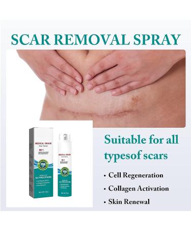 PARHAR Advanced Scar Repair Spray - For Facial Dark Spots, Surgical Scars, Stretch Marks - Relieves Scar Itching - Suitable for All Types of Scars (2PCS) - Buy Online on GoSupps.com