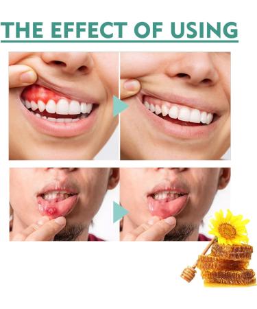 Toothache Relieving Spray Tooth Pain Relief Toothache Relief Pain Spray for Dental Pain Relief Tooth Numbing Spray Toothache Pain Relief for Adult Strong Pain Relief for Toothache Gum Pain Spray - Buy Online on GoSupps.com