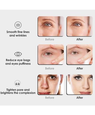 Rotating Stainless Steel Ice Globes for Facials - Unbreakable Cooling Roller Balls for Face Neck & Eyes | Anti-Aging Cryo Sticks to Reduce Dark Circles Puffiness & Wrinkles - Blue - Buy Online on GoSupps.com