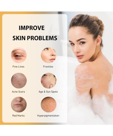 Sky Tree Lemon Turmeric Kojic Acid Soap for Hyperpigmentation - Dark Spot Treatment with Vitamin C Tea Tree Oil & Shea Butter - 2 Bars (3.5 oz each) for Face & Body - Buy Online on GoSupps.com