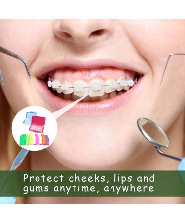 10 Pieces Orthodontic Wax for Braces - Colors & Flavors | Dental Relief Wax for Comfort - Buy Online on GoSupps.com