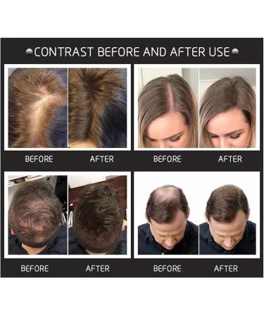 Hair Building Fibers Natural Hair Fibers for Men & Women Hair Fibres Dark Brown Hair Powder for Thinning Hair Easily Cover & Waterproof Hair Loss Concealer Instantly Conceals Hair Loss Soft Powder - Buy Online on GoSupps.com