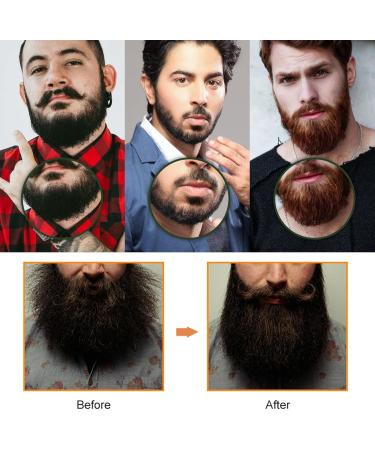 Dyceittdia 2PCs Beard Oil for Men - Natural Beard Care & Moisturizing Essential Oils (30ml x 2) - Buy Online on GoSupps.com