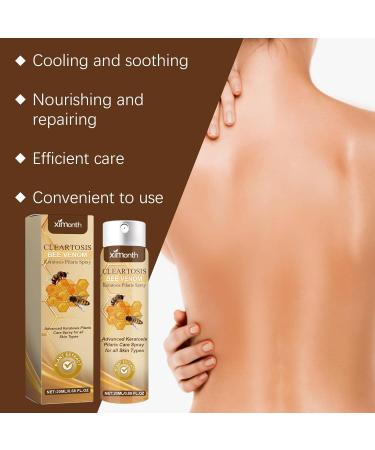 Ximonth Cleartosis Bee Venom Keratosis Pilaris Spray Advanced Care for All Skin Types 20ml/0.68 FL.OZ - Buy Online on GoSupps.com
