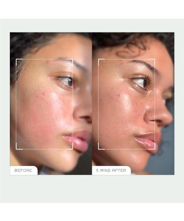 REN Clean Skincare Evercalm Redness Relief Serum - Clinically Proven to Reduce Redness & Strengthen Skin Barrier for Sensitive Skin - Shop Now - Buy Online on GoSupps.com