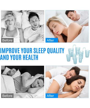 Snore Nasal Dilators 4-Pack - Effective Anti Snoring Devices for Men and Women - Stop Snoring with Professional Relief - Mini Comfortable Sleeping Aid in Blue and Light Blue - Buy Online on GoSupps.com