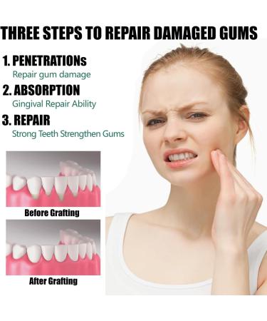  MagiSel Gum Regeneration Gel 30ml Gum Relief Drops Relief for Gum Sensitivity and Bleeding Gums - Buy Online on GoSupps.com