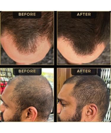 Hairline Powder by The Beard Struggle - Root Touch Up Hair Color for Men | Conceals Hair Loss & Bald Spots | Sweat Resistant Dark Brown - Buy Online on GoSupps.com