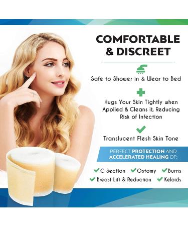 Silikan Upsize Gel Scar Silicone Tape - Medical Grade Keloid Scar Strips for Fast Breast Tissue Recovery - Extra Long Roll Sheets - Buy Online on GoSupps.com