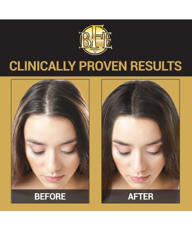 Maximum Strength DHT Blocker Hair Regrowth Conditioner for Men & Women - Stimulates New Follicle Growth for Thicker, Fuller, Longer & Healthier Hair - No Side Effects - Buy Online on GoSupps.com