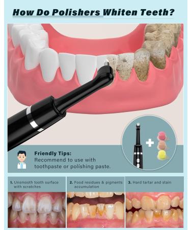 Tooth Whitening Set - Stim-U-Dent Bleaching Kit with 5 Modes 5 Heads & 3 Polishing Pastes for Superior Teeth Cleaning & Whitening - Buy Online on GoSupps.com